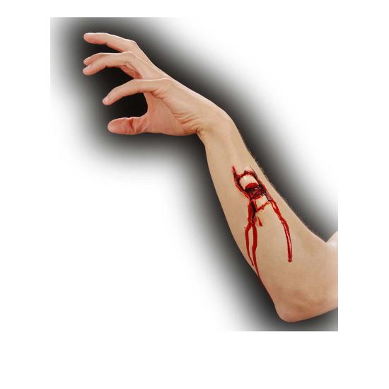 Fractura de hueso Fractura de hueso