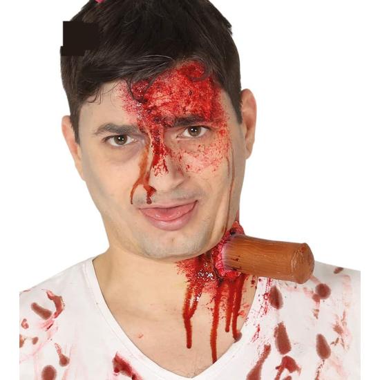 Cicatriz Estaca con Pegamento Liquido. Cicatriz Estaca con Pegamento Liquido.