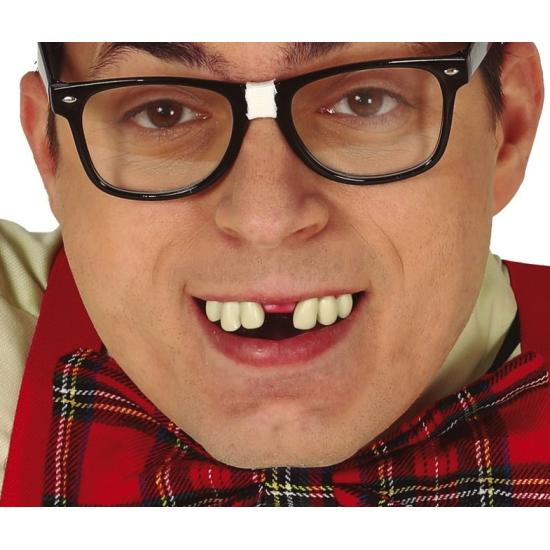 Dientes Mellados con Thermoplastica Dientes Mellados con Thermoplastica